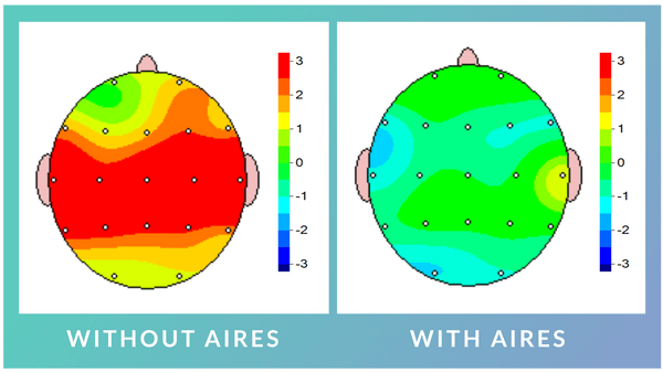 Aires Brain Scan Before and After